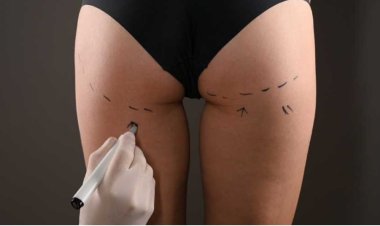 Brezilya Kalça Estetiğini Kimler Yaptırabilir?